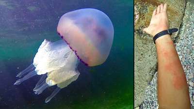 Какие медузы водятся в Азовском море? Жалят ли они людей?